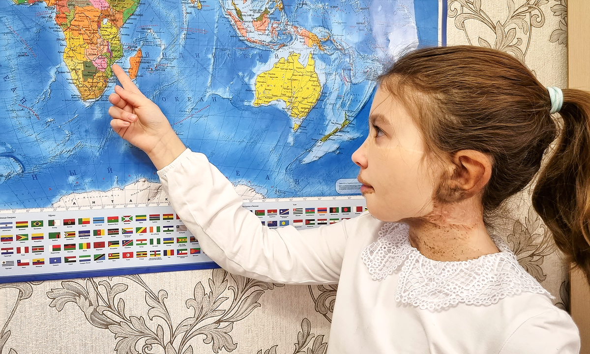 Диана Брагина, подопечная фонда "Алёша"