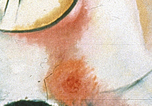 Розовый центр. Фрагмент "Композиции VI"