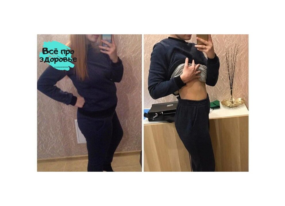 До / После! Дочитав до конца вы узнаете много интересного!