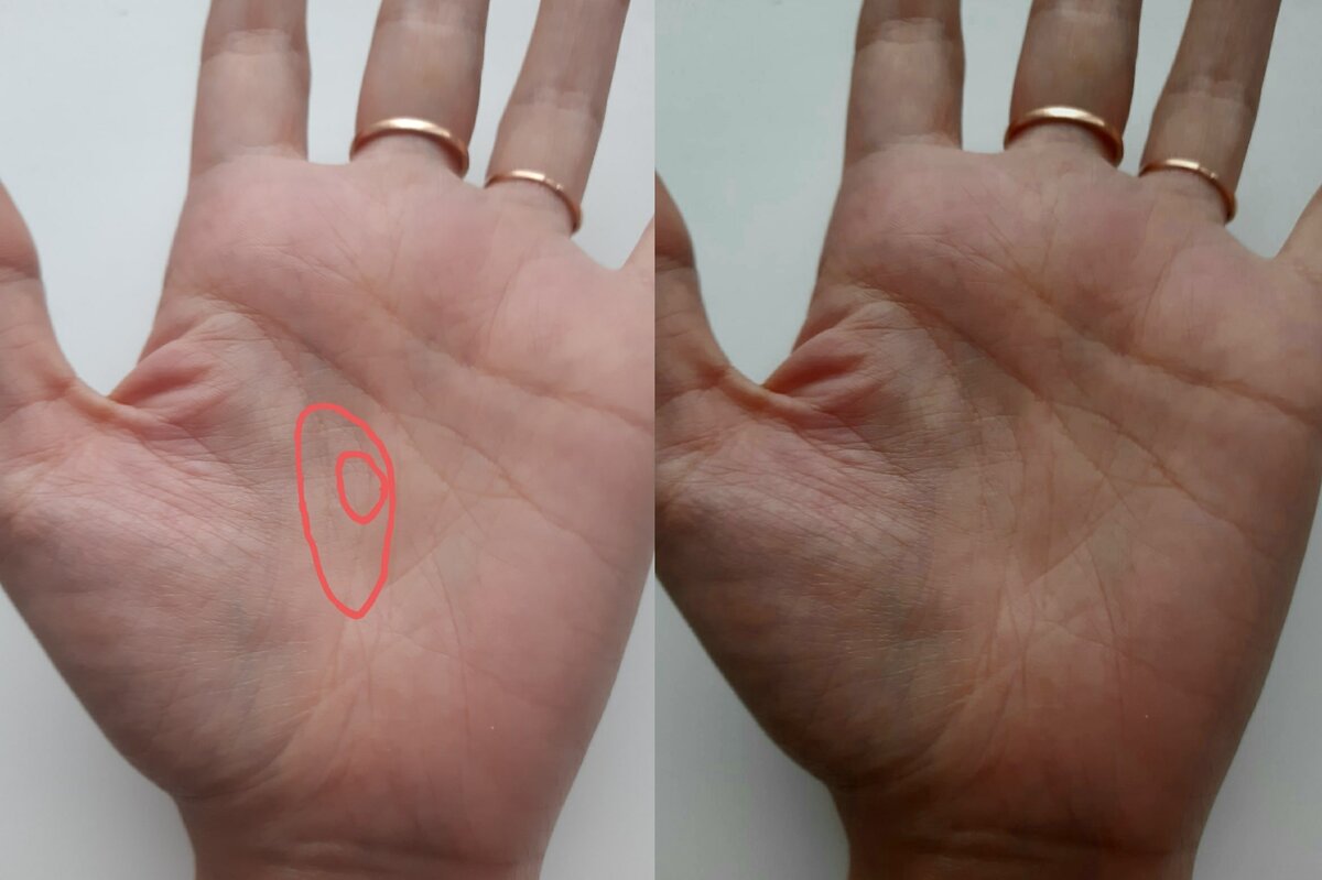 Линия жизни на руке фото с расшифровкой для женщин на правой по годам