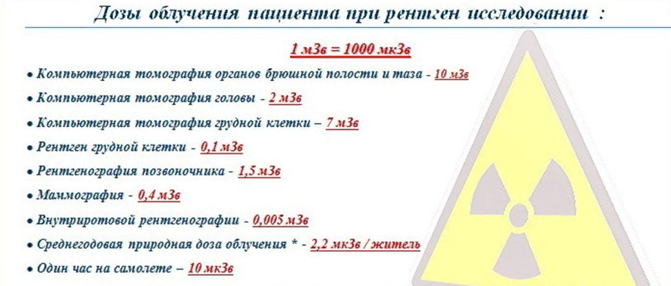 Излучение год. Доза облучения флюорография, рентген кт. Дозы облучения кт таблица МЗВ. Кт и рентген дозы облучения. Доза излучения при рентгене легких.