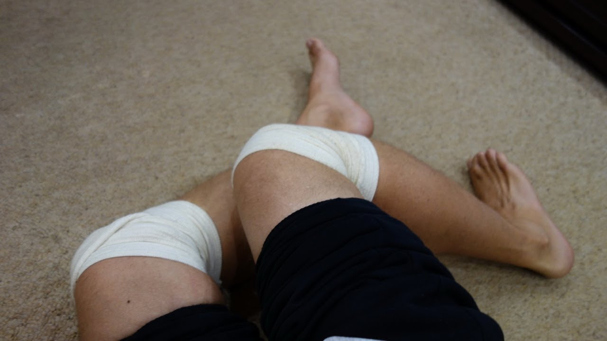 Videos knee. Колено. Больные колени.