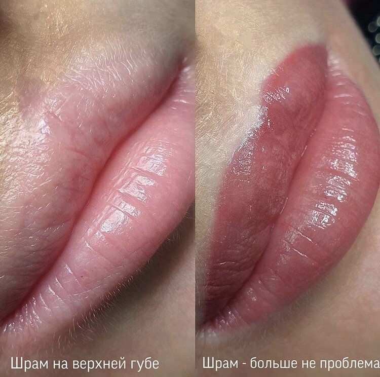 -2-2