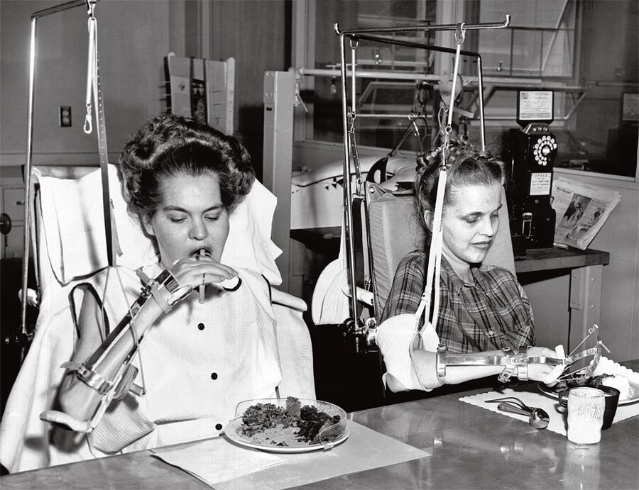 Полиомиелит