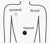 Как правильно снимать ЭКГ?