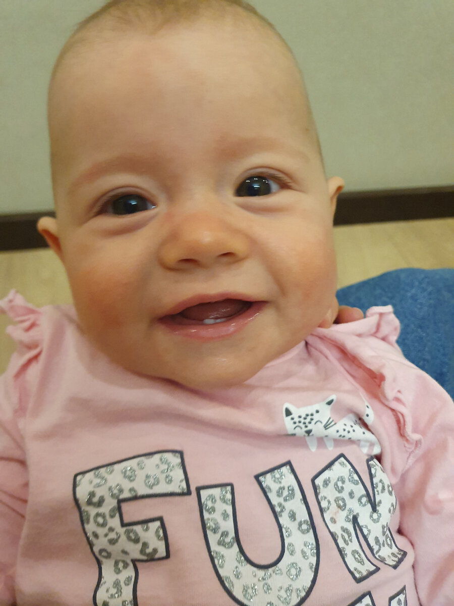 Фото сделано в период сухой кожи, на нем видны красные щеки дочки