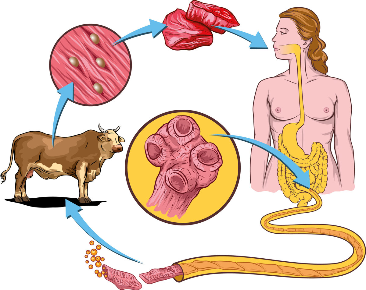 Цистицеркоз свиней возбудитель