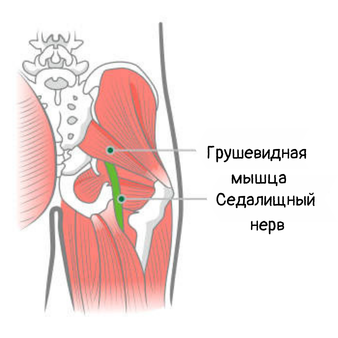 Лечение грушевидной мышцы