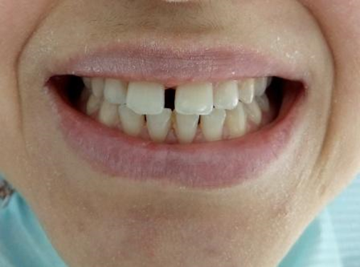 Изначальный вид