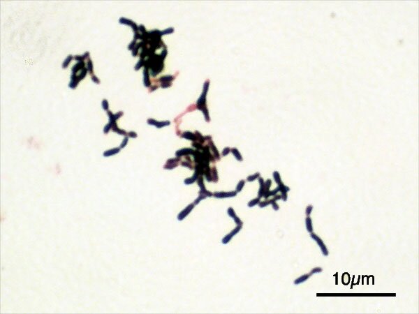    Bifidobacterium. Один из видов кишечных бактерийВикипедия