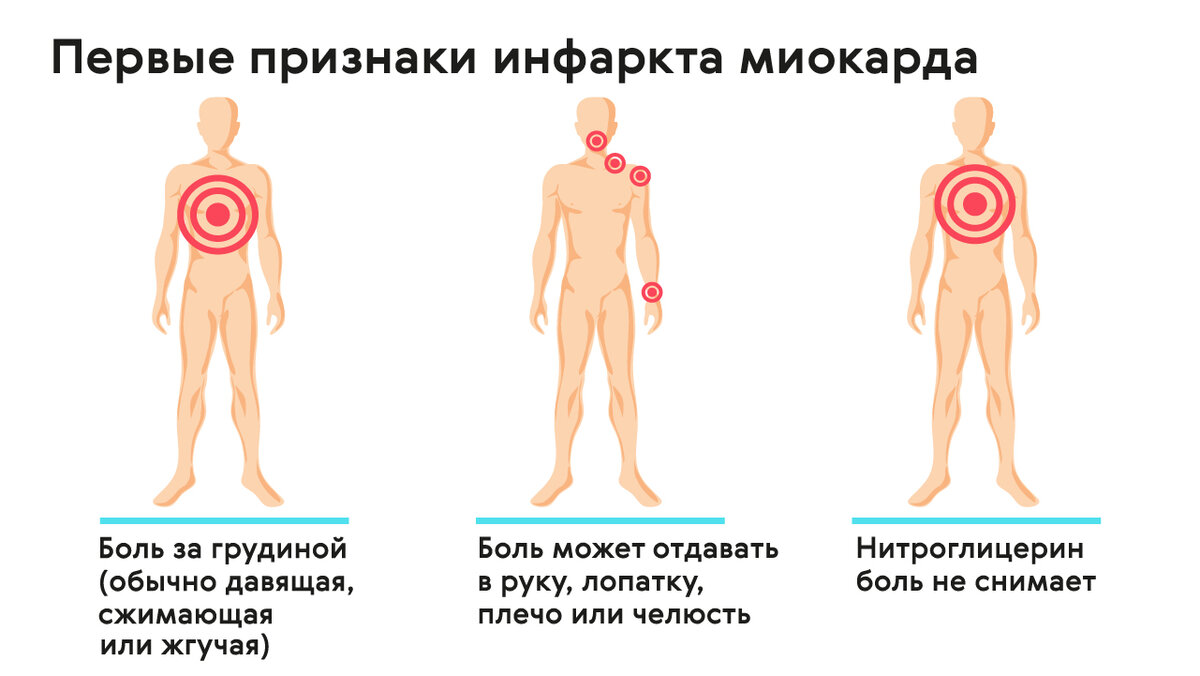 Причины боли в области грудины | Мир ортопедии | Дзен