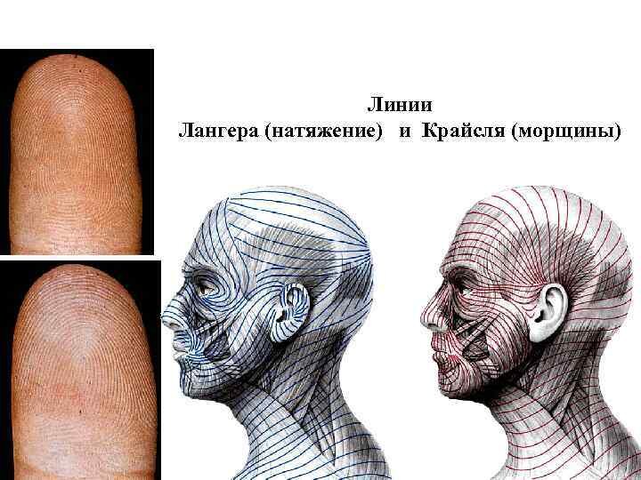 Линии лангера фото