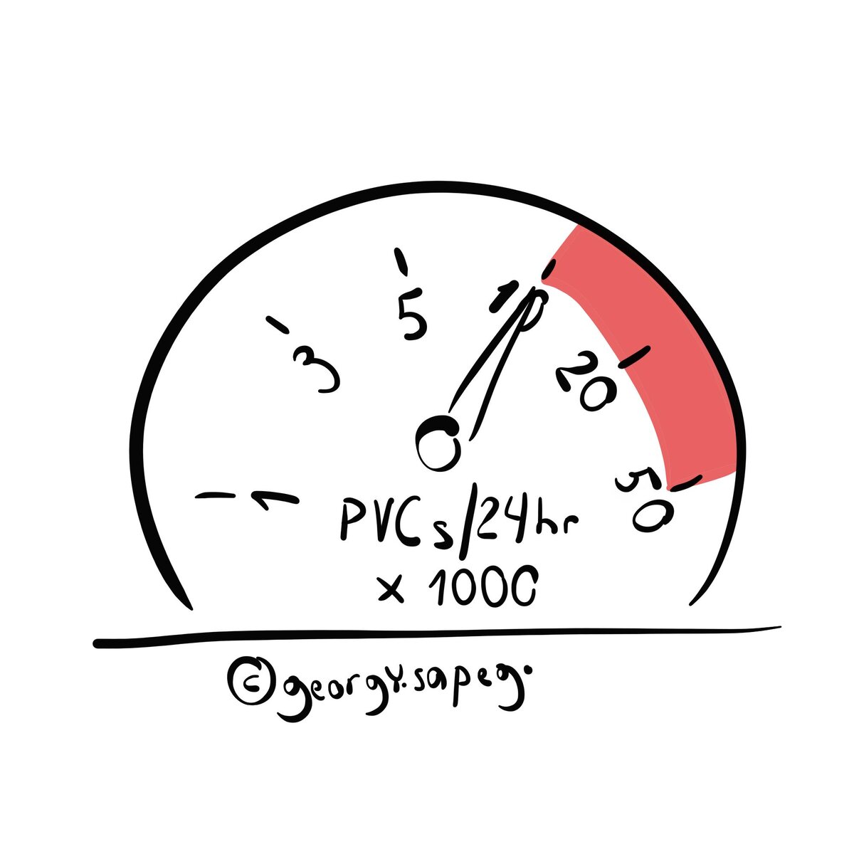 Вредное количество желудочковых экстрасистол в сутки