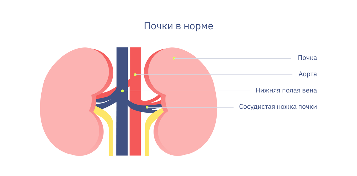 Опущение почки – симптомы, причины, признаки, диагностика и лечение в «СМ-Клиника»