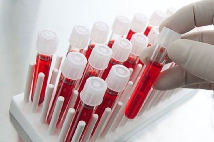 Сдавать анализ крови нужно делать минимум раз в год. 