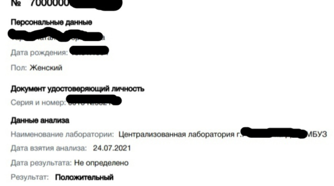 Результат сданного пцр после потери обоняния