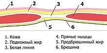  
Схема белой линии живота, поперечное сечение, над пупком
