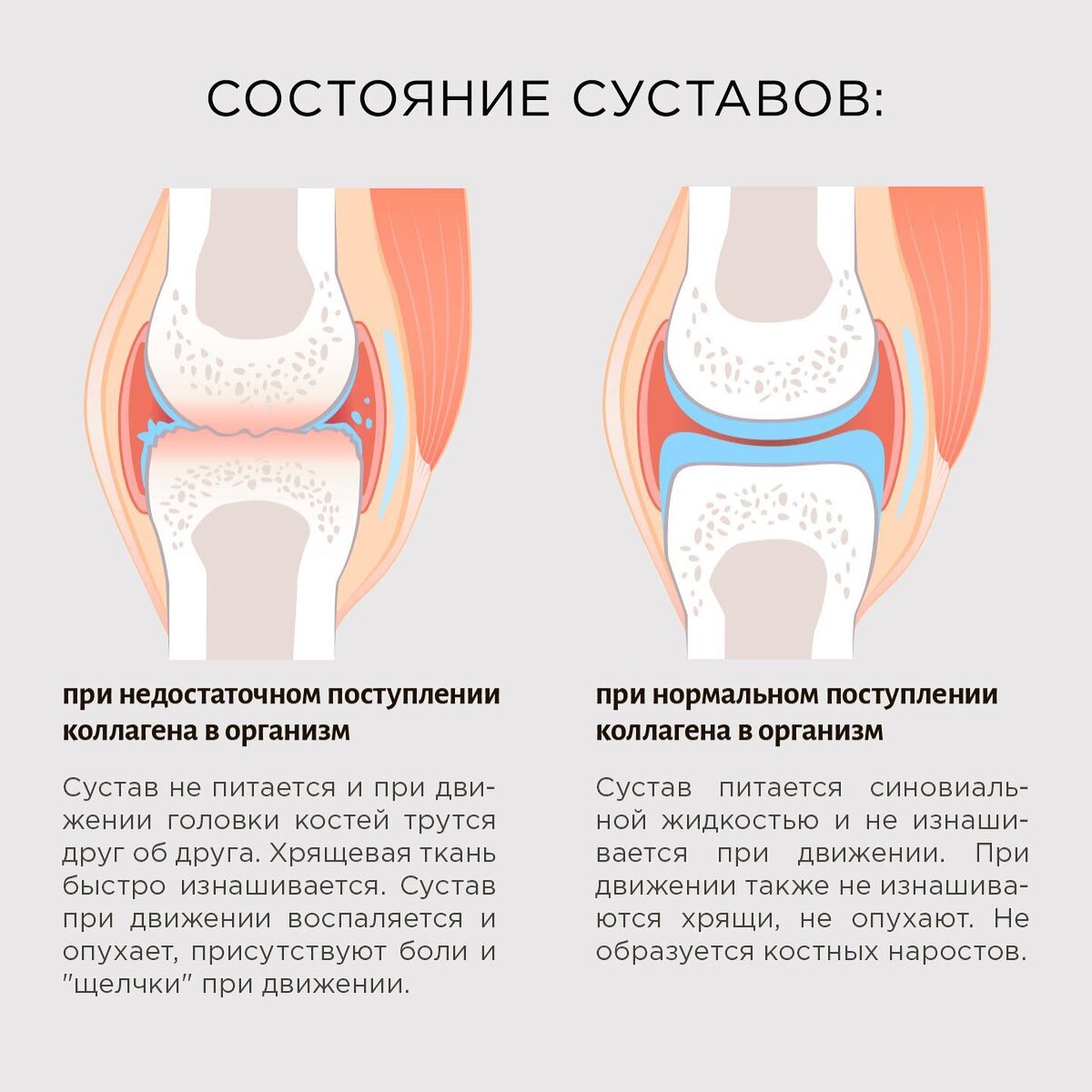 Влияние коллагена на суставы 