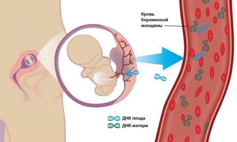 Открытый источник.