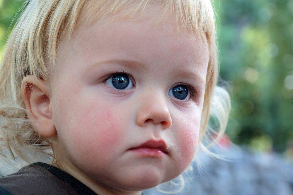 Почему у ребенка красные щеки и как это связано с зубами: отвечают врачи
