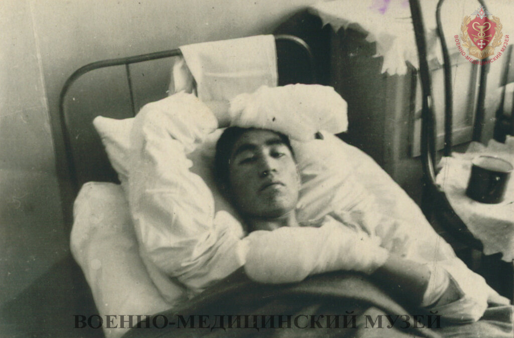 Больной с обморожением обеих кистей. Западный фронт,1942.