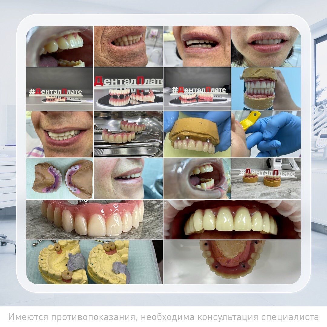 Кто такой врач ортопед?! | Dental Plats - стоматология СПБ | Дзен