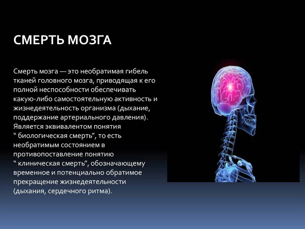 Сколько живут человек после смерти. Смерть мозга. Клиническая смерть мозга. Критерии смерти головного мозга.