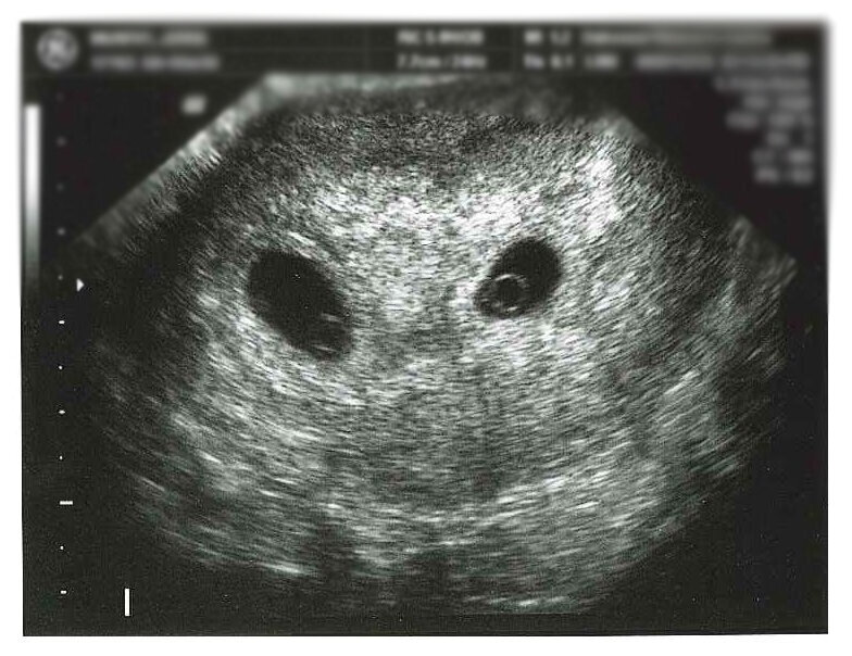 Источник:Яндекс.Картинки