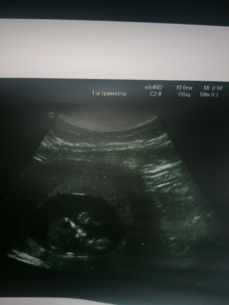 Вот малыш машет ручкой ;)