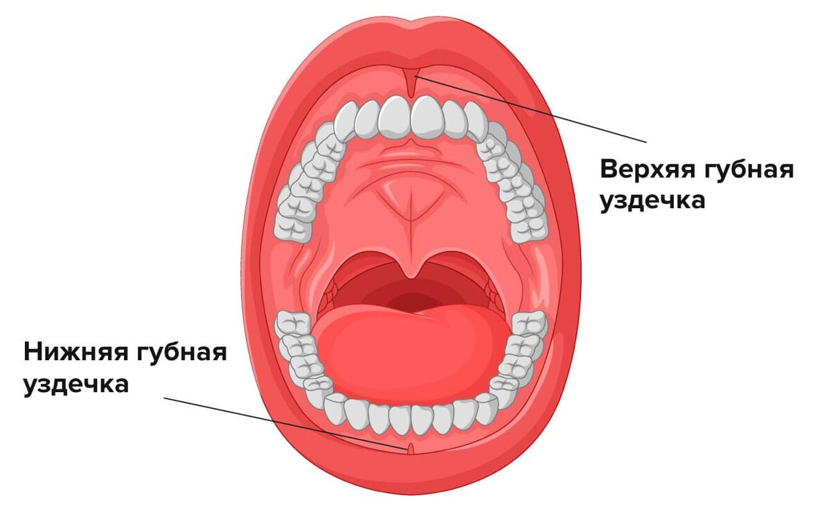 Уздечка верхней и нижней губы