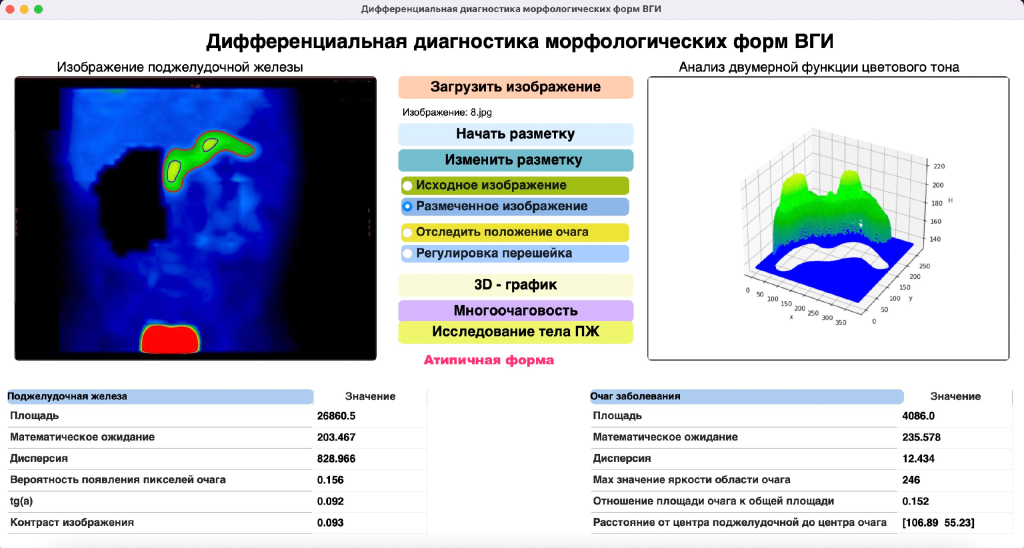 Интерфейс программы. 