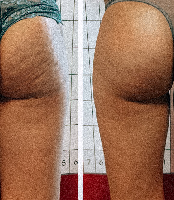              До.                                              После.                          