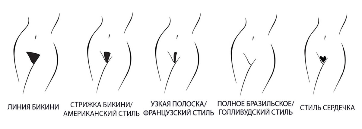 Лазерная эпиляция в Париже-18 - Косметологическая медицина во Франции, Париж