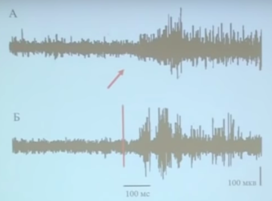 А - реакция  нейрона зрительной коры на зрительный стимул; Б - реакция нейрона зрительной коры на электрический стимул по кишечнику.