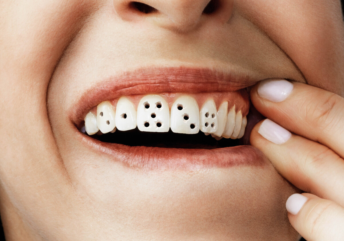 Зубы счёт любят. Изображение из свободных источников.