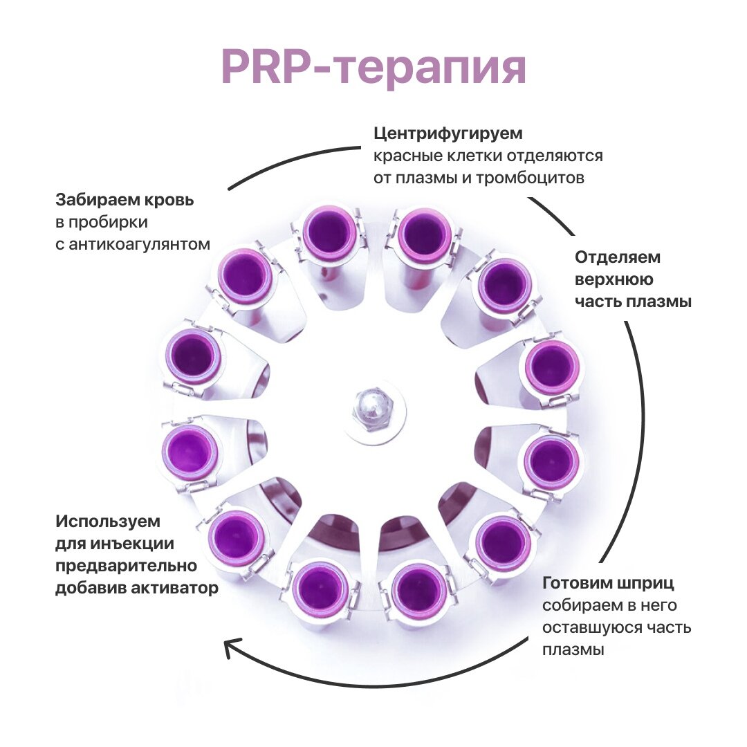 Плазма в гинекологии. PRP терапия режим центрифугирования. Плазмолифтинг PRP терапия. Плазма крови при плазмотерапии. Плазма обогащенная тромбоцитами PRP.