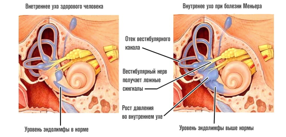 Головокружение, нарушение устойчивости и координации движений