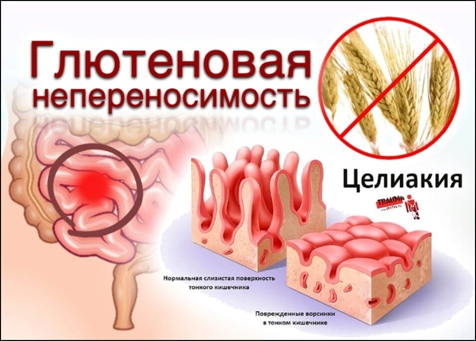 Безглютеновая диета на неделю для взрослых и детей