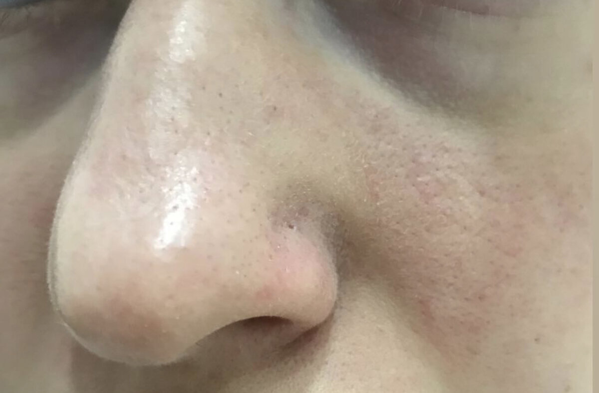 Фото ПОСЛЕ.Результат после первого раза.