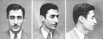 Южный европеоидный комплекс