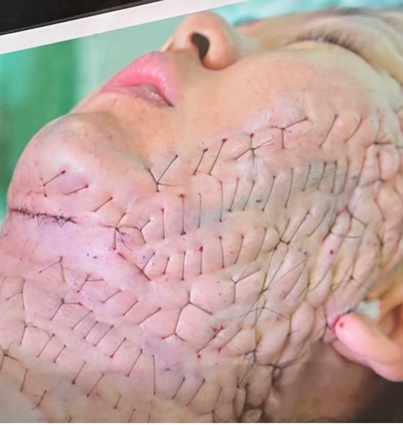 Сетка Освальда