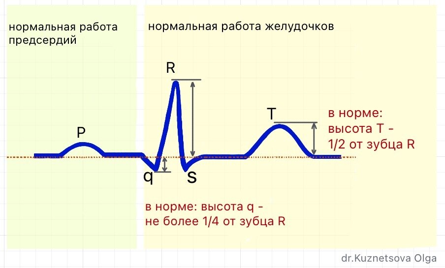 Как расшифровать электрокардиограмму (ЭКГ)?