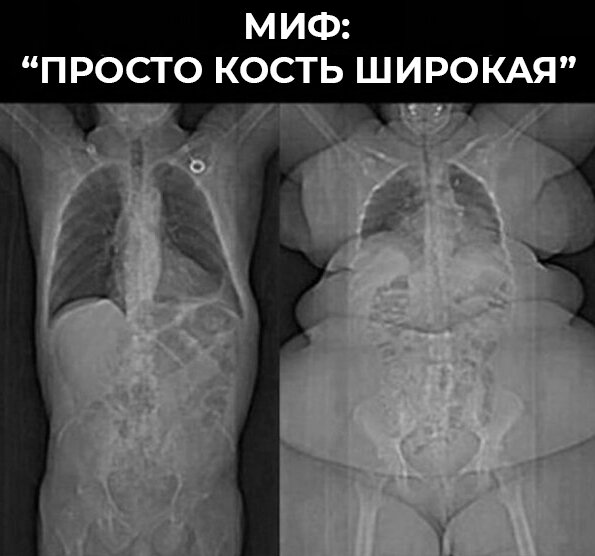 Рентген покажет всё, что скрыто