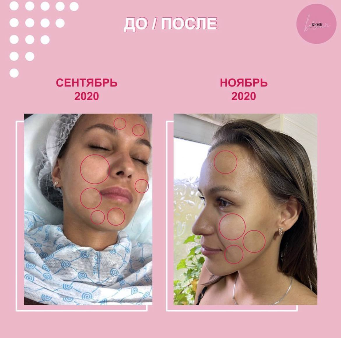 Вот как оно помогло мне.