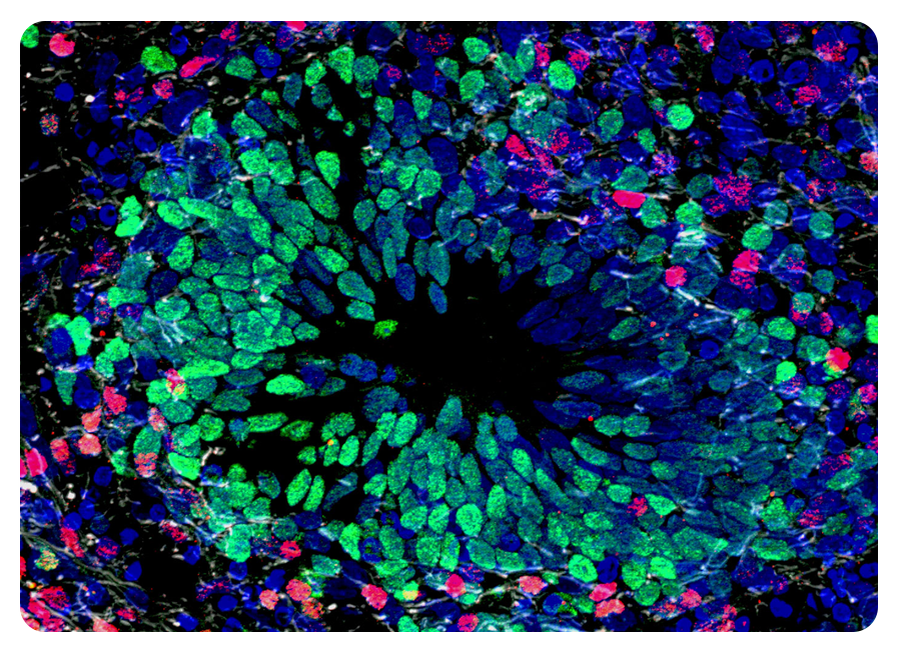 Клетки органоида дифферецируются и образуют структуры, напоминающие те, которые имеют эмбриональные ткани. Зелёные клетки — это предшественники нейронов, красные клетки — незрелые нейроны, формирующие кортикальный слой. Можно ли считать эту форму жизни по-настоящему живой? По мере того как различий между такими структурами и нашим мозгом становится всё меньше, перед исследователи возникает широкий круг этических проблем.