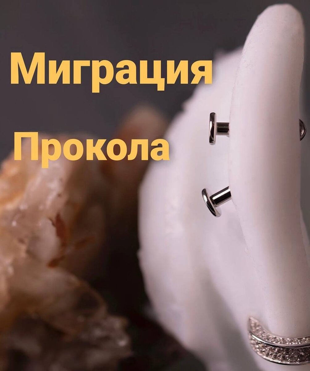 Наглядный пример мигрировавшего прокола