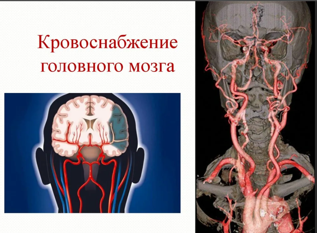 Какая артерия кровоснабжает мозг