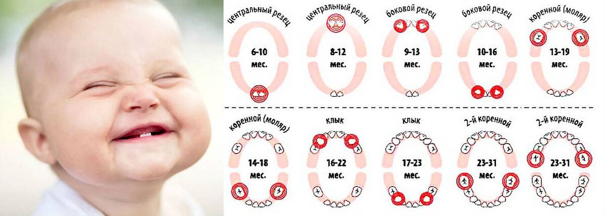 Первые зубы.Прорезывание зубов по месяцам.