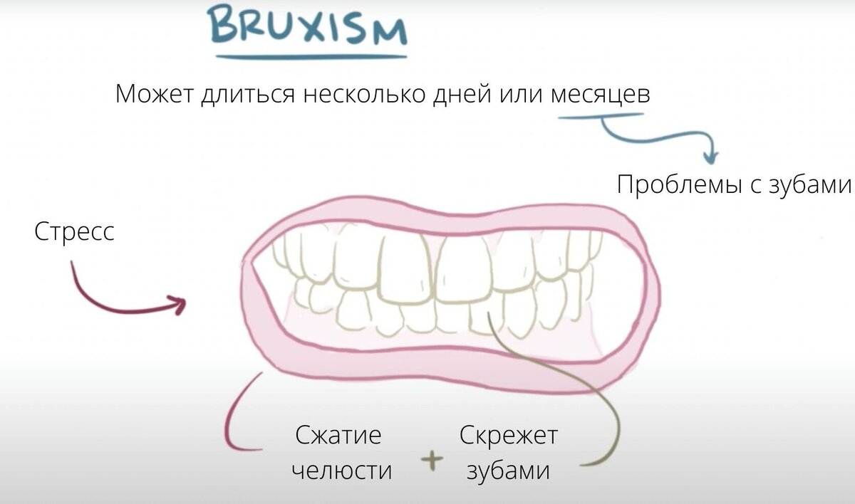 Проявление зубного скрежета. Анимация от автора.