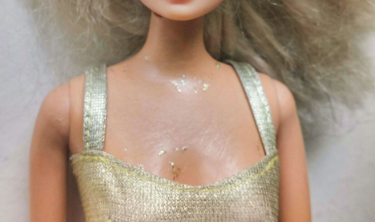 Здесь лучше видны царапины на груди